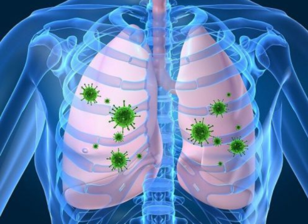 怎么鉴定呼吸套装真伪健康科普丨呼吸道感染莫慌张  13种呼吸道病原体精准检测来鉴别_https://www.jmylbn.com_新闻资讯_第3张