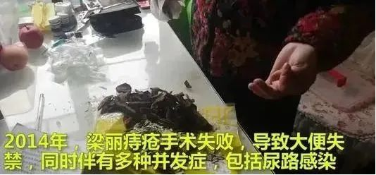 促愈凝胶怎么排出「DR.ROTUS卡波姆痔疮凝胶」消肿止痛，止血止痒，促进愈合_https://www.jmylbn.com_新闻资讯_第36张