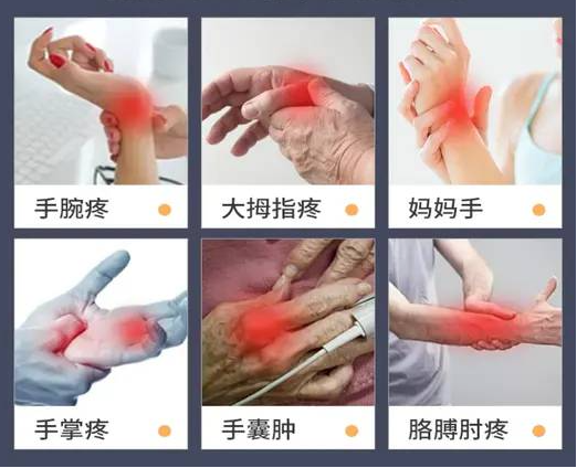 医用dr怎么选「DR.ROTUS腱鞘医用冷敷凝胶」1瓶解决手部问题鼠标手、手腕不适_https://www.jmylbn.com_新闻资讯_第37张