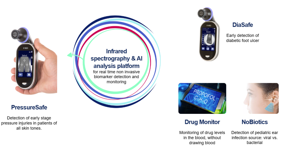欧洲有哪些医疗产品以色列领先医疗创新革命性产品_https://www.jmylbn.com_新闻资讯_第6张