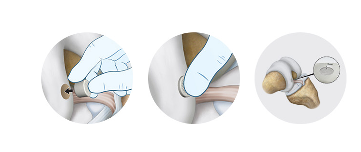 欧洲有哪些医疗产品以色列领先医疗创新革命性产品_https://www.jmylbn.com_新闻资讯_第2张