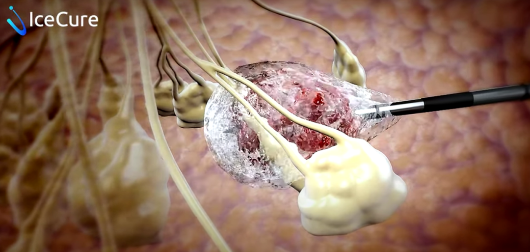 欧洲有哪些医疗产品以色列领先医疗创新革命性产品_https://www.jmylbn.com_新闻资讯_第5张