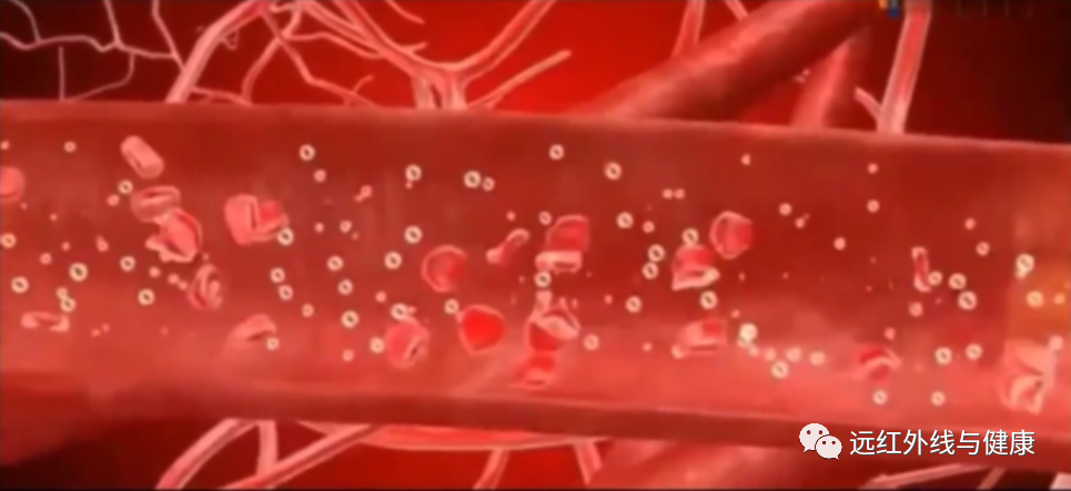 什么红外线理疗好远红外理疗法你关心的问题都在这里！_https://www.jmylbn.com_新闻资讯_第4张