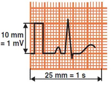 心电图怎么切换导联原来读懂心电图可以如此简单！_https://www.jmylbn.com_新闻资讯_第8张