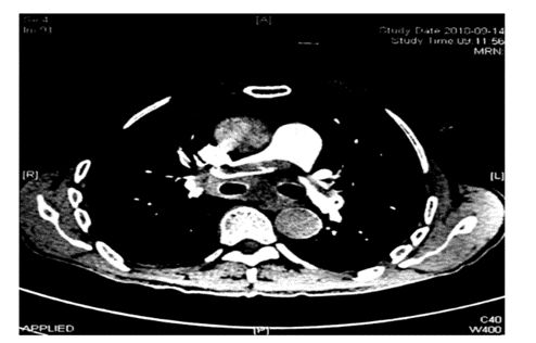 心电图怎么切换导联原来读懂心电图可以如此简单！_https://www.jmylbn.com_新闻资讯_第7张