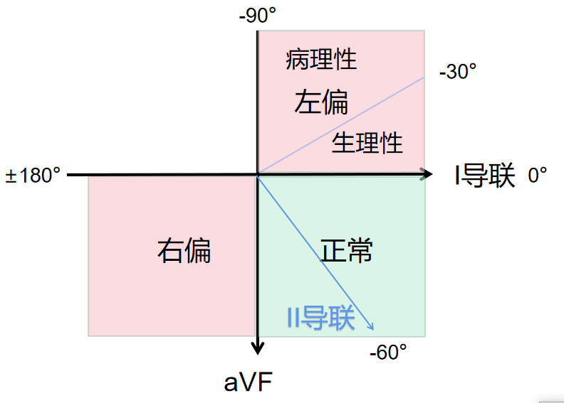 心电图怎么切换导联心电图基础思维方法论，看完的都收藏了_https://www.jmylbn.com_新闻资讯_第8张