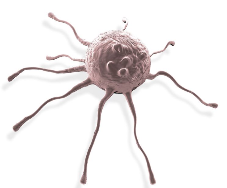 穿刺枪怎么升级乳腺穿刺术（三）_https://www.jmylbn.com_新闻资讯_第71张