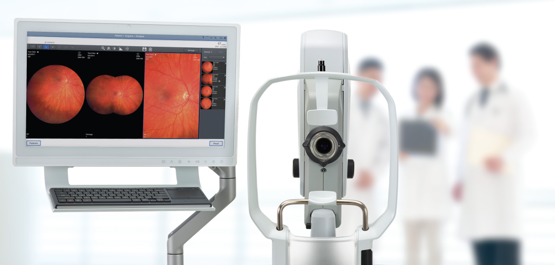 眼底照相机怎么眼底一张照眼病早知道丨蔡司CLARUS 500真彩·高清·超广角眼底相机_https://www.jmylbn.com_新闻资讯_第1张