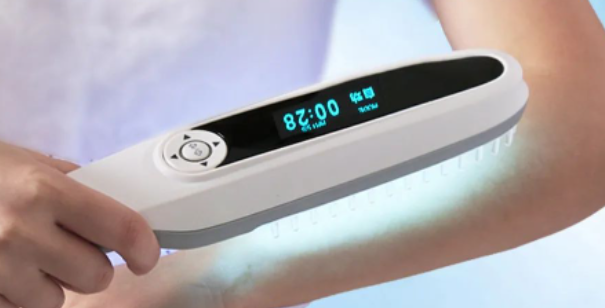 4006B光疗怎么用使用家用光疗仪真的能治好白斑吗？_https://www.jmylbn.com_新闻资讯_第4张