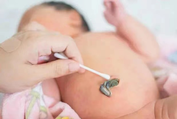 为什么剪脐带要先夹住剪脐带是妈妈疼还是宝宝疼呢？需要注意什么？_https://www.jmylbn.com_新闻资讯_第6张