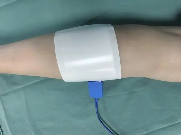 为什么手术用电刀外科医生的“魔法刀”：揭秘手术室里的高频电刀​​_https://www.jmylbn.com_新闻资讯_第6张