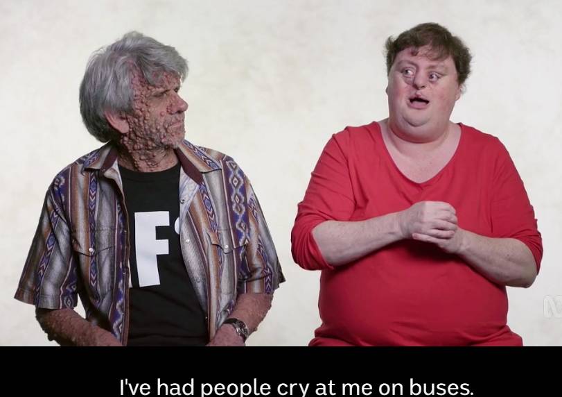 你不覺得自己像個sb嗎 土澳這檔節目簡直瘋了 竟然問出如此喪心病狂的問題 悉尼印象 微文庫