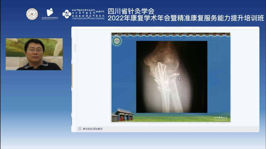 成都顾连锦宸康复医院连续5年承办四川省针灸学会康复学术年会