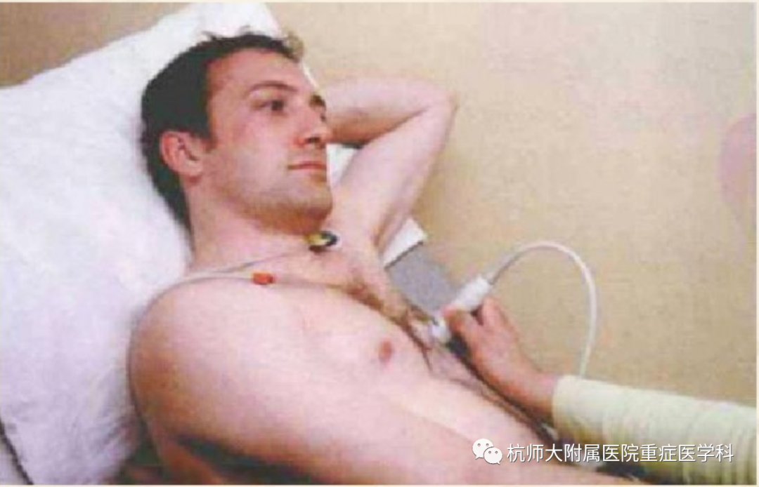 什么是超声容积探头重症心脏超声图像的获取_https://www.jmylbn.com_新闻资讯_第9张