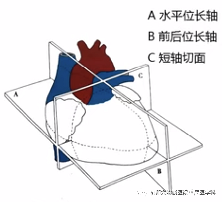 什么是超声容积探头重症心脏超声图像的获取_https://www.jmylbn.com_新闻资讯_第10张