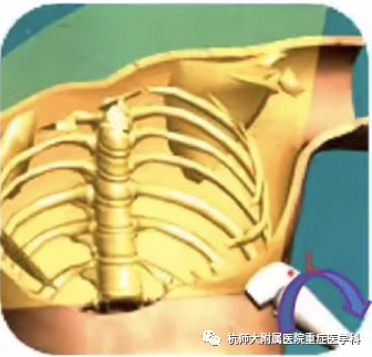 什么是超声容积探头重症心脏超声图像的获取_https://www.jmylbn.com_新闻资讯_第21张