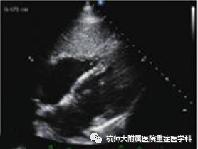 什么是超声容积探头重症心脏超声图像的获取_https://www.jmylbn.com_新闻资讯_第30张