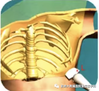 什么是超声容积探头重症心脏超声图像的获取_https://www.jmylbn.com_新闻资讯_第17张