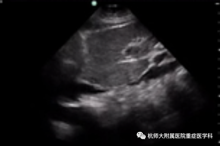 什么是超声容积探头重症心脏超声图像的获取_https://www.jmylbn.com_新闻资讯_第32张
