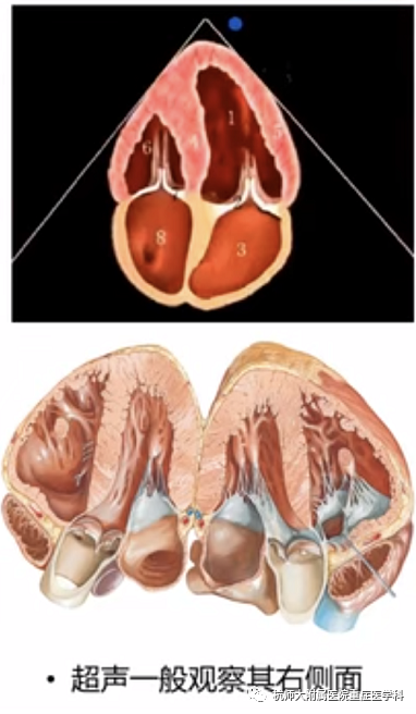 什么是超声容积探头重症心脏超声图像的获取_https://www.jmylbn.com_新闻资讯_第12张