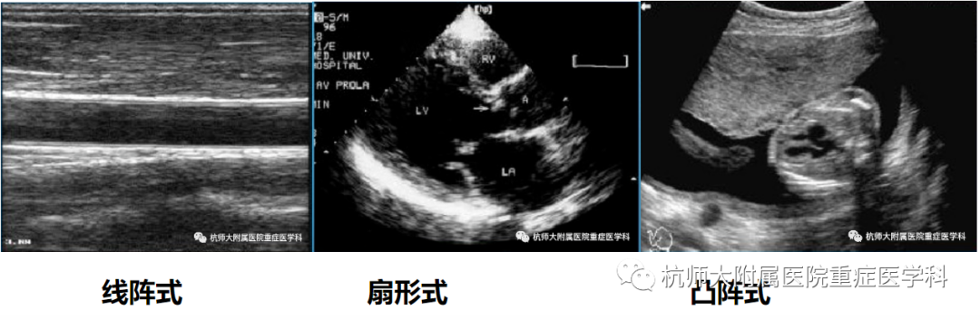 什么是超声容积探头重症心脏超声图像的获取_https://www.jmylbn.com_新闻资讯_第4张