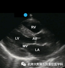 什么是超声容积探头重症心脏超声图像的获取_https://www.jmylbn.com_新闻资讯_第14张