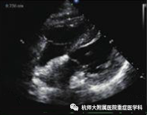 什么是超声容积探头重症心脏超声图像的获取_https://www.jmylbn.com_新闻资讯_第29张