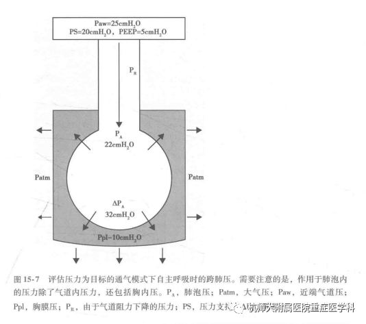为什么呼吸机人机同步机械通气-人机不同步_https://www.jmylbn.com_新闻资讯_第7张