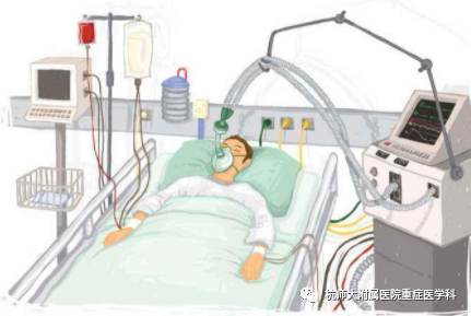 为什么呼吸机人机同步机械通气-人机不同步_https://www.jmylbn.com_新闻资讯_第2张