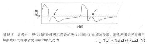 为什么呼吸机人机同步机械通气-人机不同步_https://www.jmylbn.com_新闻资讯_第9张