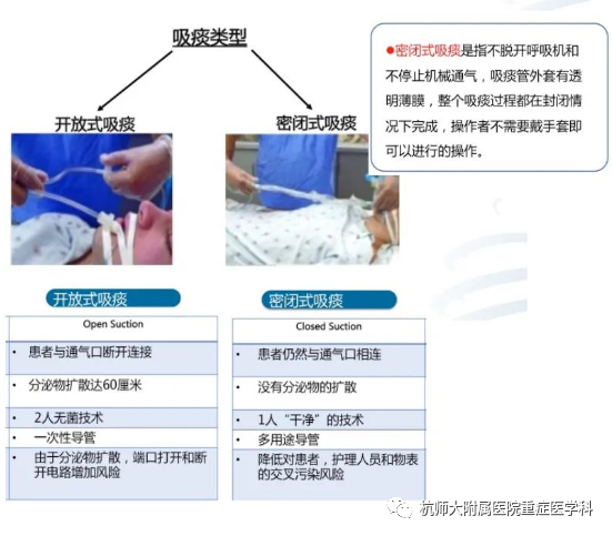 为什么使用密闭式吸痰管重症护理——密闭式吸痰管的使用_https://www.jmylbn.com_新闻资讯_第3张