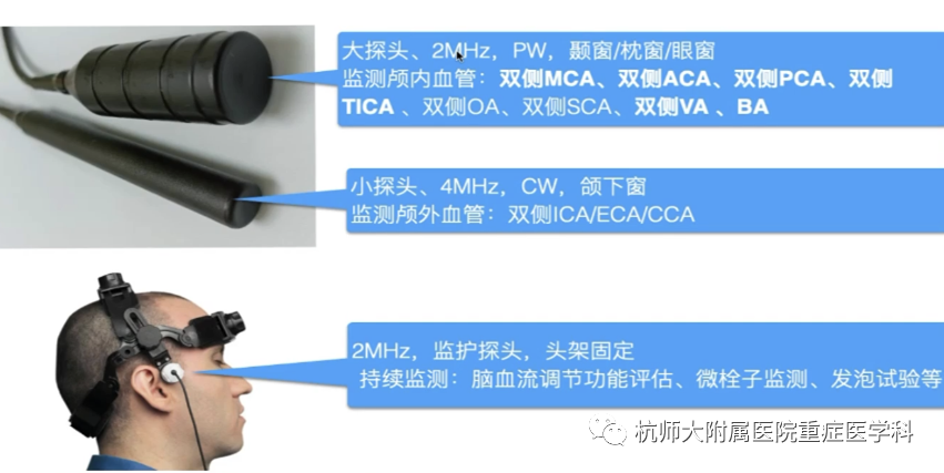 TCD怎么切换探头重症超声-颅脑多普勒血流信号的获取_https://www.jmylbn.com_新闻资讯_第13张