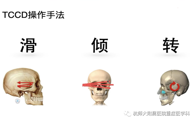 TCD怎么切换探头重症超声-颅脑多普勒血流信号的获取_https://www.jmylbn.com_新闻资讯_第21张