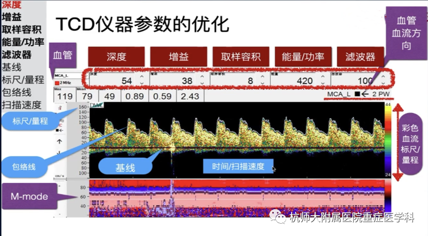 TCD怎么切换探头重症超声-颅脑多普勒血流信号的获取_https://www.jmylbn.com_新闻资讯_第2张