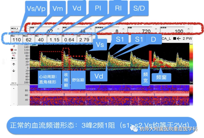 TCD怎么切换探头重症超声-颅脑多普勒血流信号的获取_https://www.jmylbn.com_新闻资讯_第18张