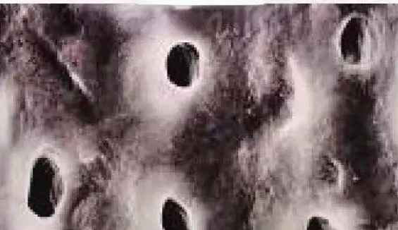 口腔激光怎么治疗你相信“光”吗？近距离了解航天中心医院口腔科激光治疗_https://www.jmylbn.com_新闻资讯_第18张