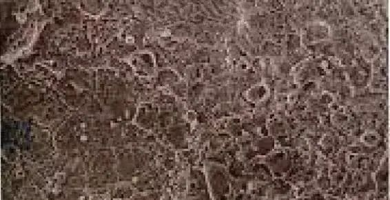 口腔激光怎么治疗你相信“光”吗？近距离了解航天中心医院口腔科激光治疗_https://www.jmylbn.com_新闻资讯_第19张