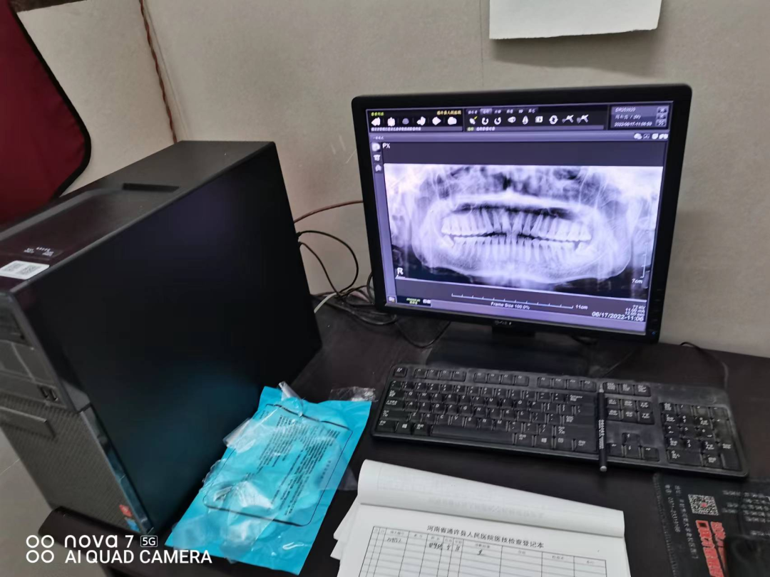 x光机怎么拍牙片【科普】快来围观放射科的那些“宝贝”！_https://www.jmylbn.com_新闻资讯_第9张
