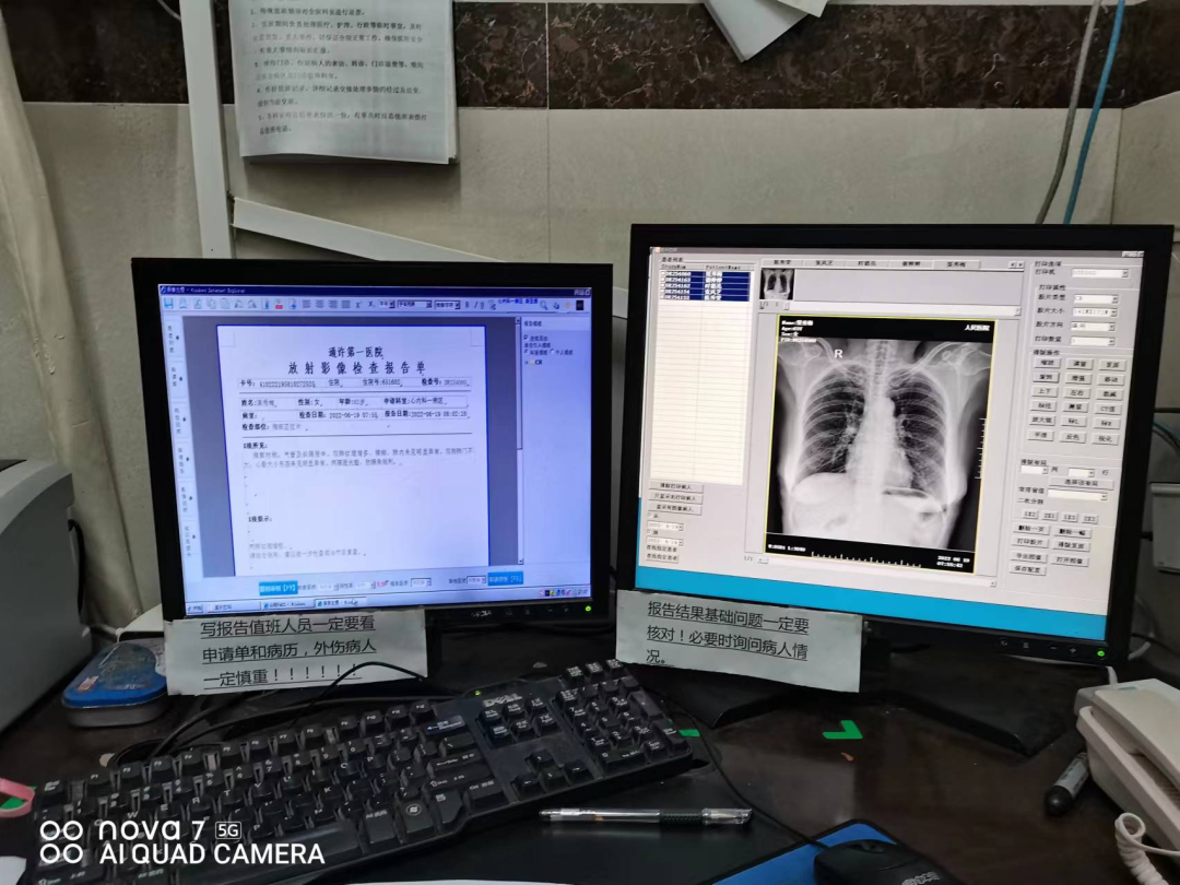 x光机怎么拍牙片【科普】快来围观放射科的那些“宝贝”！_https://www.jmylbn.com_新闻资讯_第3张