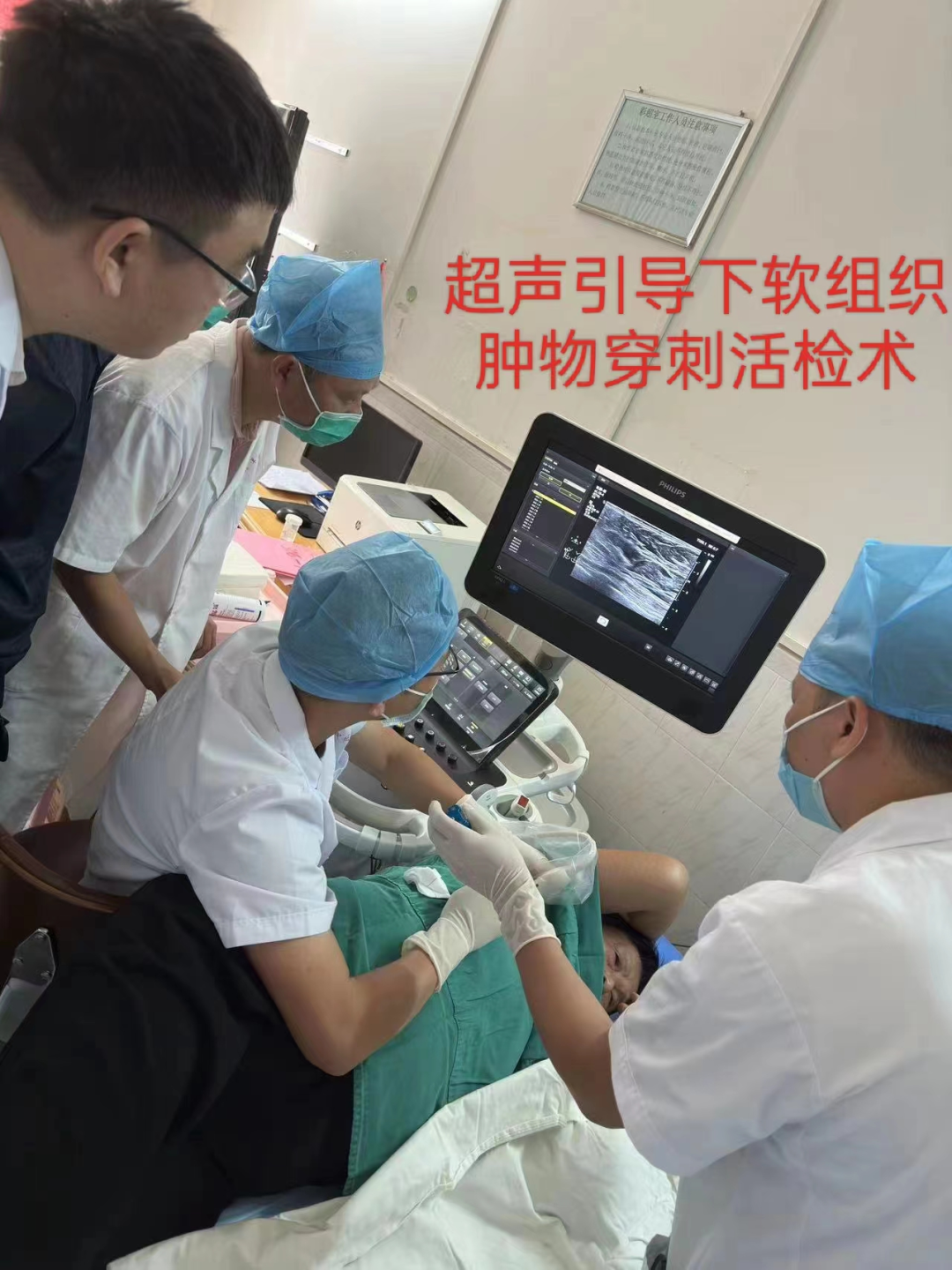 prosound超声怎么调查看部位介入超声，化解患者疾苦，为医患保驾护航！_https://www.jmylbn.com_新闻资讯_第5张