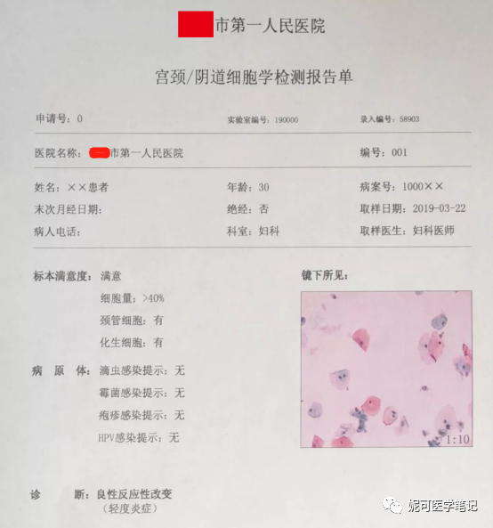 lct怎么检查#学习分享233#宫颈癌筛查：宫颈TCT报告结果如何解读？_https://www.jmylbn.com_新闻资讯_第16张