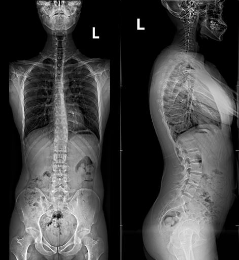 dr设备是什么【五期工程设备展示：联影uDR】联影智能DR在邵逸夫医院新大楼正式启用_https://www.jmylbn.com_新闻资讯_第7张