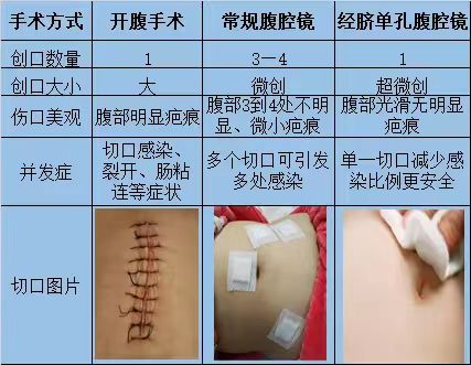 妇科腹腔镜切口位置图片