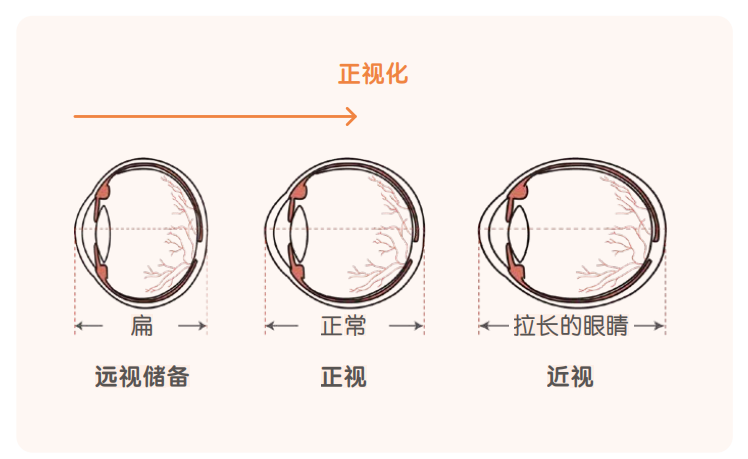 眼科生物测量仪怎么看认识眼轴生物测量仪，科学精准配镜！_https://www.jmylbn.com_新闻资讯_第5张