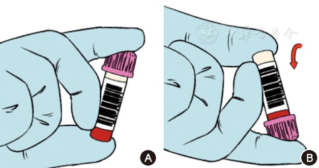 微量采血管怎么使用中国末梢采血操作共识_https://www.jmylbn.com_新闻资讯_第10张