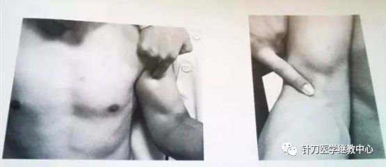 外展枕怎么使用干货 ｜ 针刀治疗要点规程定点定位_https://www.jmylbn.com_新闻资讯_第23张