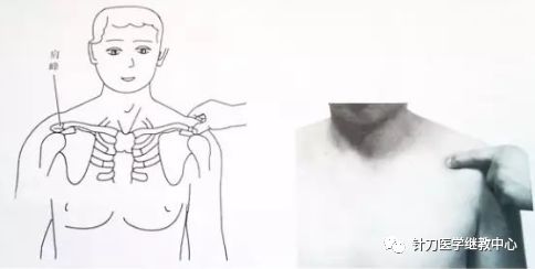 外展枕怎么使用干货 ｜ 针刀治疗要点规程定点定位_https://www.jmylbn.com_新闻资讯_第17张