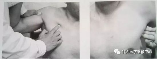 外展枕怎么使用干货 ｜ 针刀治疗要点规程定点定位_https://www.jmylbn.com_新闻资讯_第29张