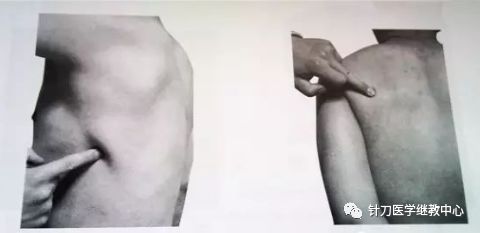 外展枕怎么使用干货 ｜ 针刀治疗要点规程定点定位_https://www.jmylbn.com_新闻资讯_第30张