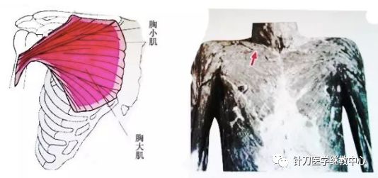 外展枕怎么使用干货 ｜ 针刀治疗要点规程定点定位_https://www.jmylbn.com_新闻资讯_第36张